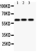 1 - Anti-Perforin Picoband Antibody ABO11852