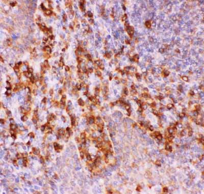 2 - Anti-PROM1 Picoband Antibody ABO11853