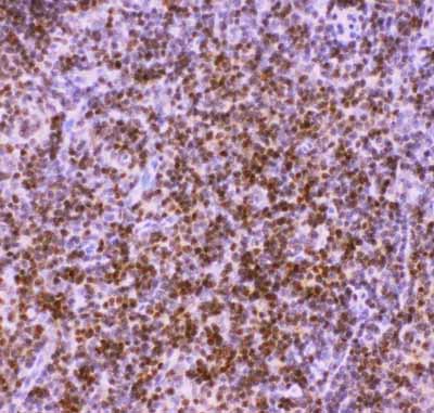 2 - Anti-RUNX1/AML1 Picoband Antibody ABO11854