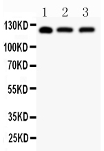 1 - Anti-SIRT1 Picoband Antibody ABO11856
