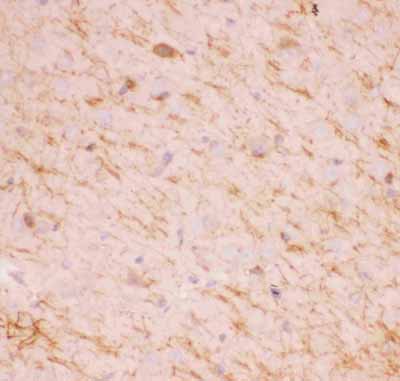 2 - Anti-SIRT2 Picoband Antibody ABO11857