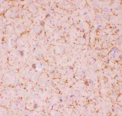 2 - Anti-SIRT2 Picoband Antibody ABO11857