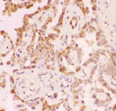 2 - Anti-SIRT2 Picoband Antibody ABO11857