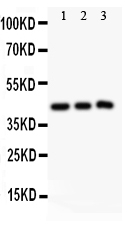 1 - Anti-SIRT2 Picoband Antibody ABO11857