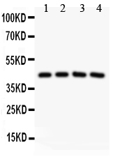 1 - Anti-SIRT3 Picoband Antibody ABO11858