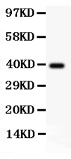 1 - Anti-TdT Picoband Antibody ABO11859