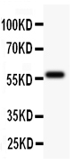 1 - Anti-TdT Picoband Antibody ABO11859