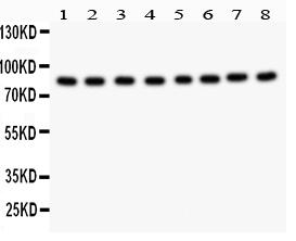 1 - Anti-B Raf Picoband Antibody ABO11860