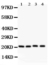 1 - Anti-Caveolin-1 Picoband Antibody ABO11861