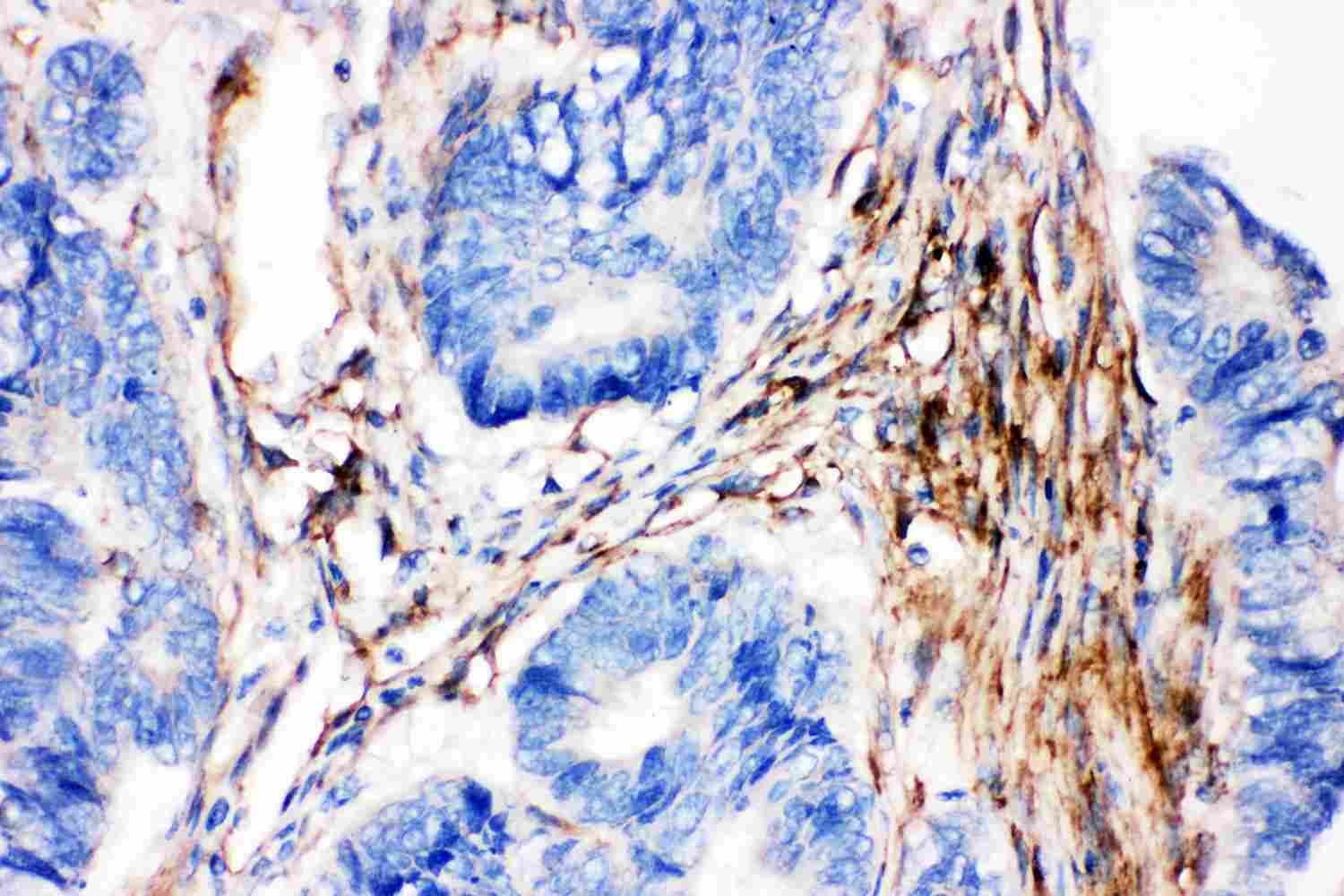 2 - Anti-Caveolin-2 Picoband Antibody ABO11862