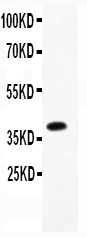 1 - Anti-Caveolin-2 Picoband Antibody ABO11862