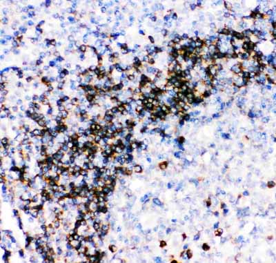 2 - Anti-CD79a Picoband Antibody ABO11863