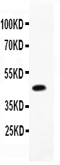 1 - Anti-CD79a Picoband Antibody ABO11863