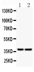 1 - Anti-CD79a Picoband Antibody ABO11863