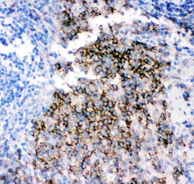 2 - Anti-CD79b Picoband Antibody ABO11864