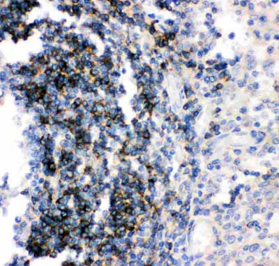 2 - Anti-CD79b Picoband Antibody ABO11864