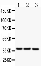 1 - Anti-CD79b Picoband Antibody ABO11864