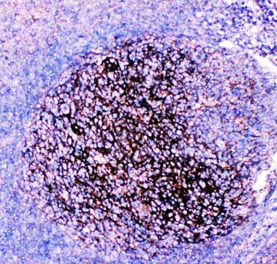2 - Anti-CD82 Picoband Antibody ABO11865