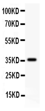 1 - Anti-CD82 Picoband Antibody ABO11865