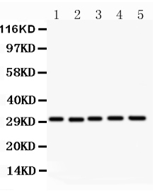 1 - Anti-CD82 Picoband Antibody ABO11865