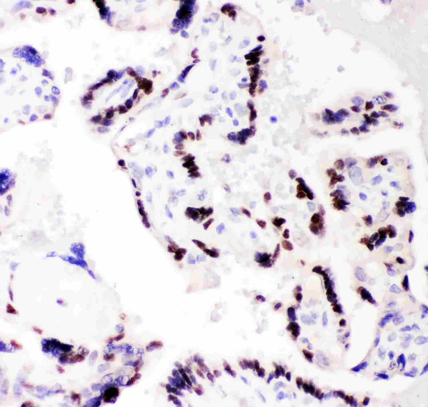 2 - Anti-CEBP Beta Picoband Antibody ABO11866