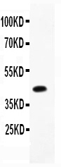 1 - Anti-CEBP Beta Picoband Antibody ABO11866