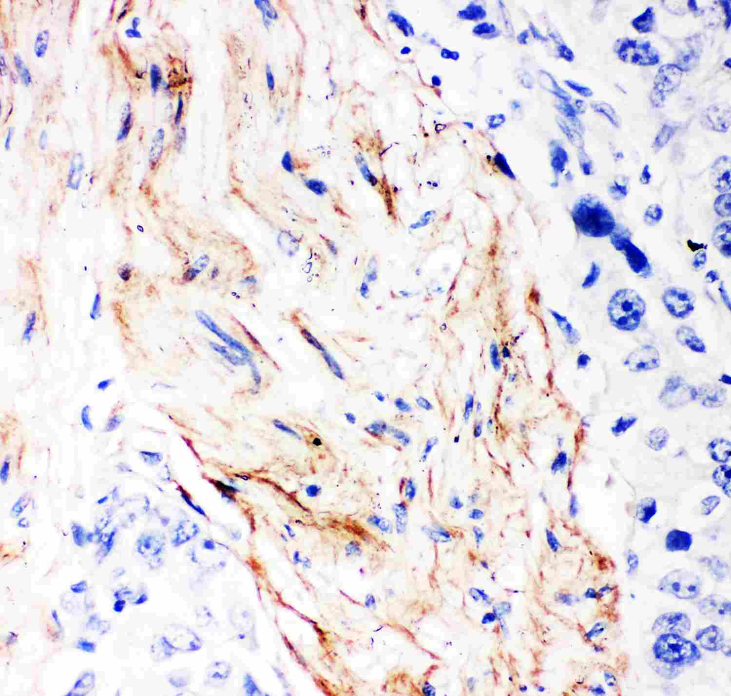 2 - Anti-Decorin Picoband Antibody ABO11867