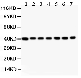 1 - Anti-Decorin Picoband Antibody ABO11867