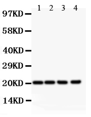 1 - Anti-DHFR Picoband Antibody ABO11868