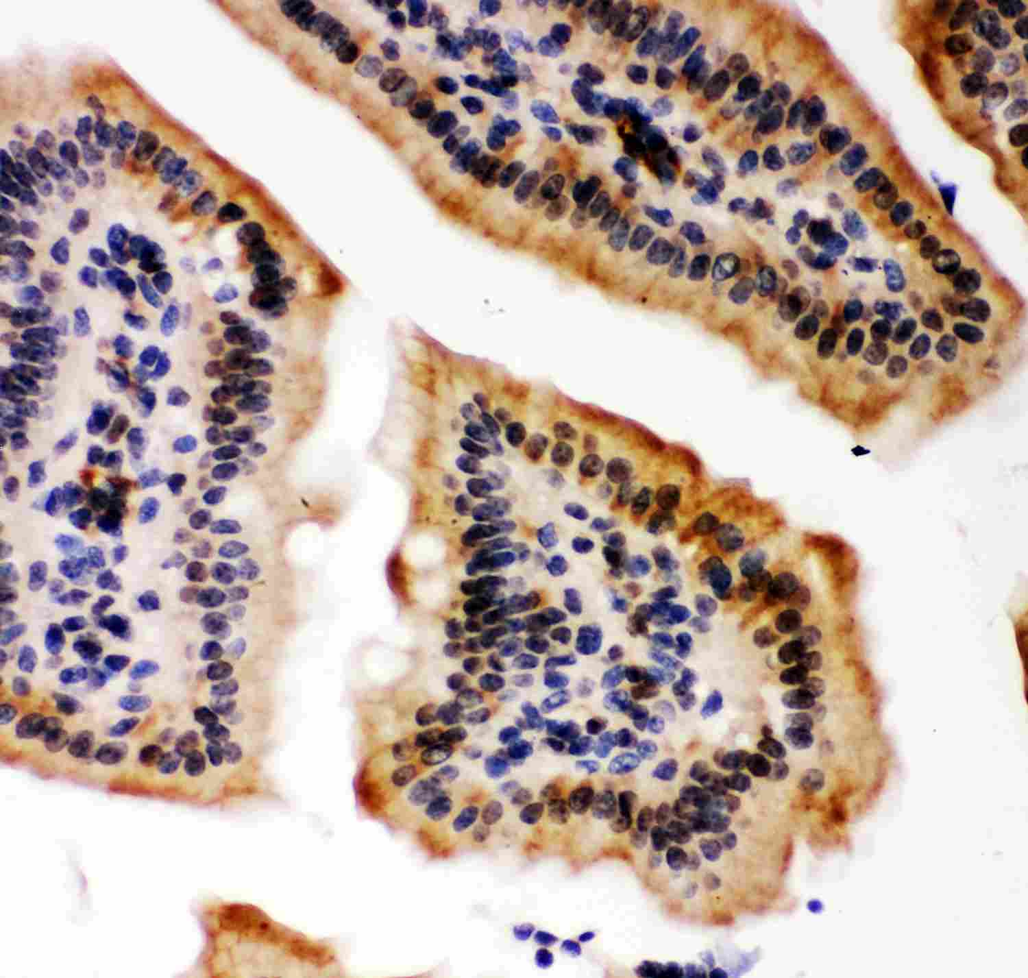 2 - Anti-KAT3B/p300 Picoband Antibody ABO11870
