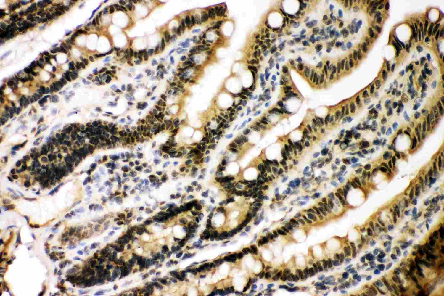2 - Anti-KAT3B/p300 Picoband Antibody ABO11870