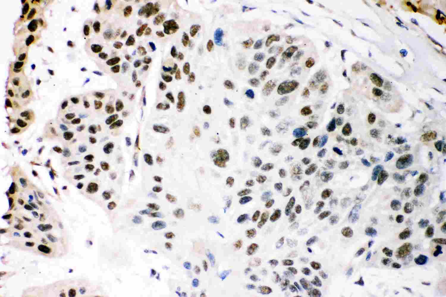 2 - Anti-KAT3B/p300 Picoband Antibody ABO11870