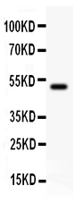 1 - Anti-EPB41L1 Picoband Antibody ABO11871