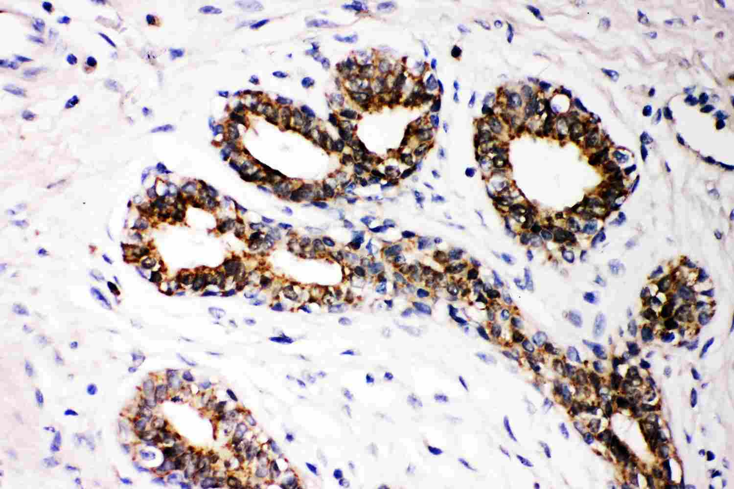 2 - Anti-FHIT Picoband Antibody ABO11873