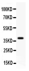 1 - Anti-FHIT Picoband Antibody ABO11873