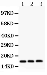 1 - Anti-FHIT Picoband Antibody ABO11873