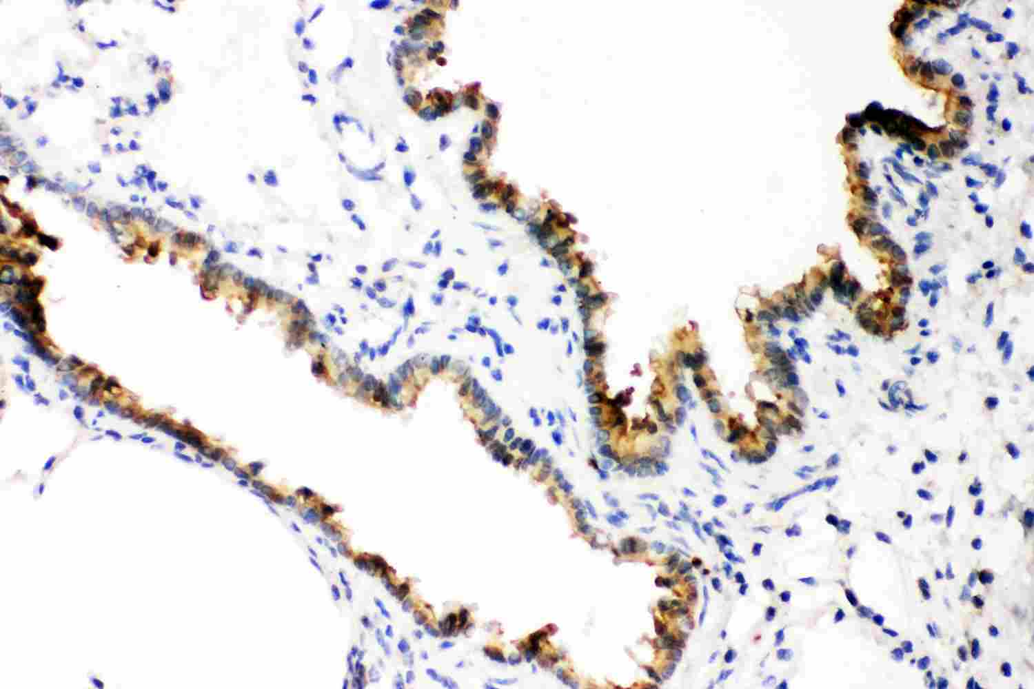 2 - Anti-GST3/GST Pi Picoband Antibody ABO11876