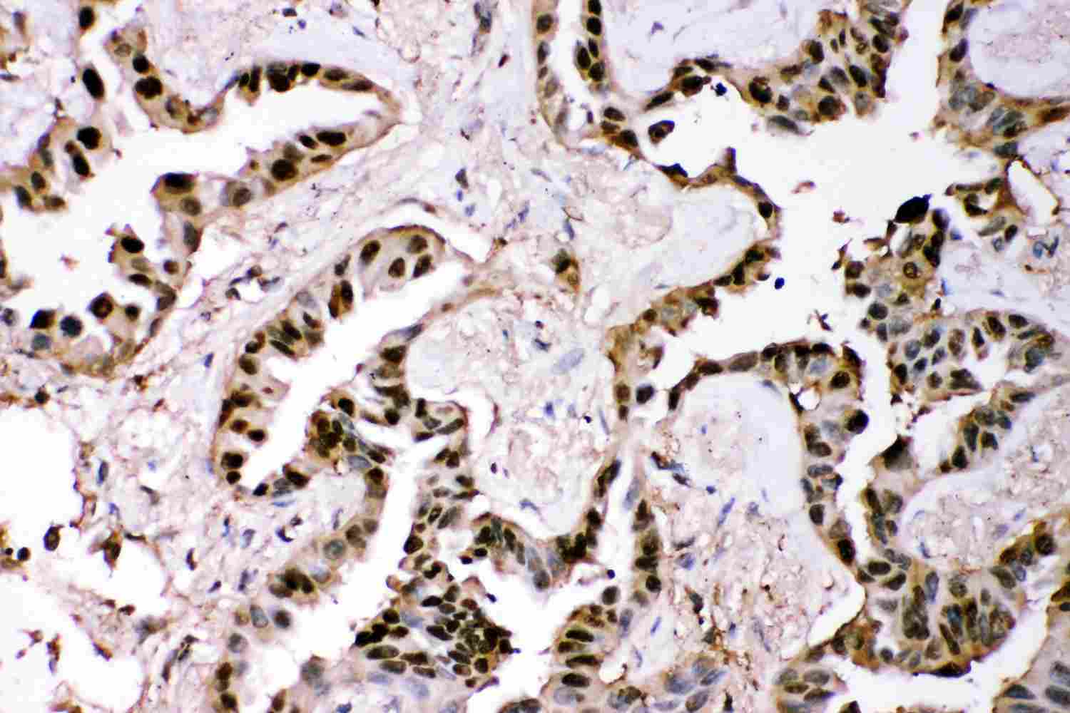 2 - Anti-GST3/GST Pi Picoband Antibody ABO11876