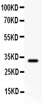1 - Anti-GST3/GST Pi Picoband Antibody ABO11876