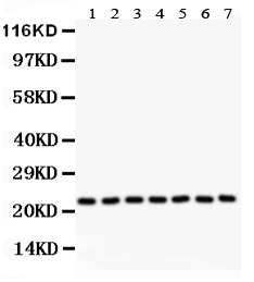 1 - Anti-GST3/GST Pi Picoband Antibody ABO11876