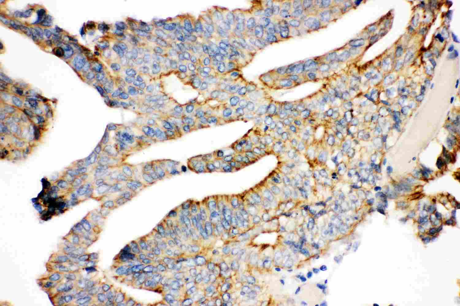 2 - Anti-Gamma Catenin Picoband Antibody ABO11877