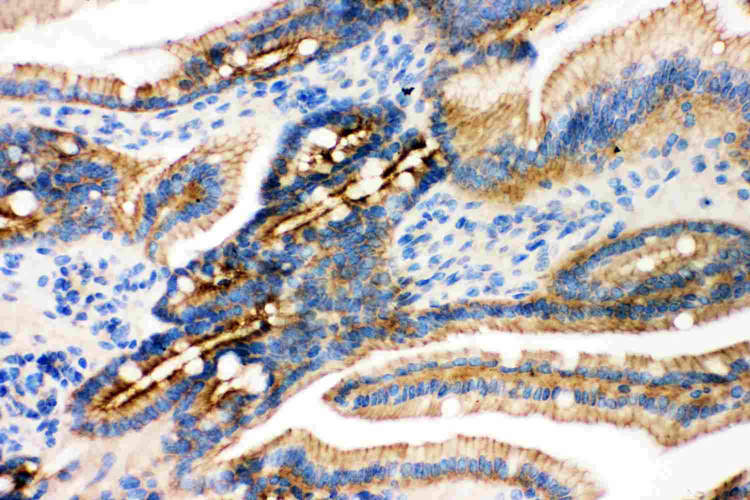 2 - Anti-Gamma Catenin Picoband Antibody ABO11877
