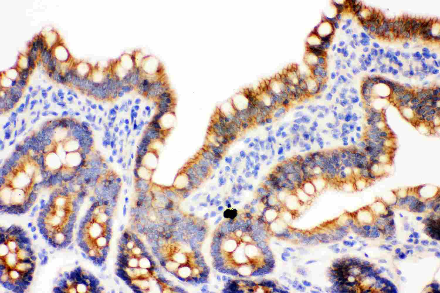 2 - Anti-Gamma Catenin Picoband Antibody ABO11877