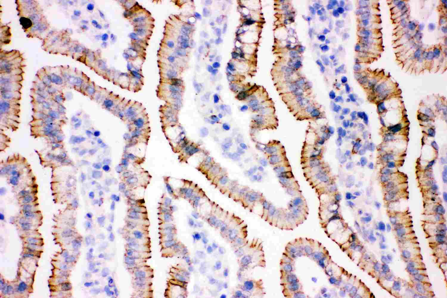 2 - Anti-Gamma Catenin Picoband Antibody ABO11877