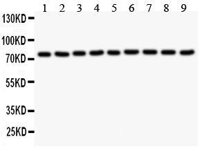 1 - Anti-Gamma Catenin Picoband Antibody ABO11877