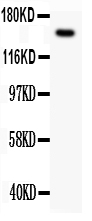 1 - Anti-C-MET/HGFR Antibody ABO11878