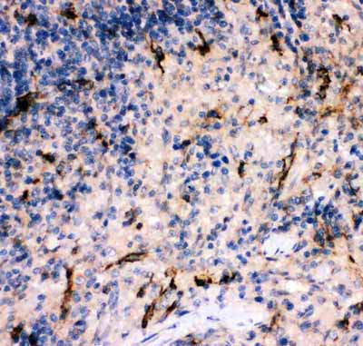 2 - Anti-complement C5a Antibody ABO11879