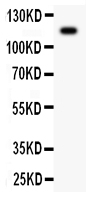 1 - Anti-complement C5a Antibody ABO11879