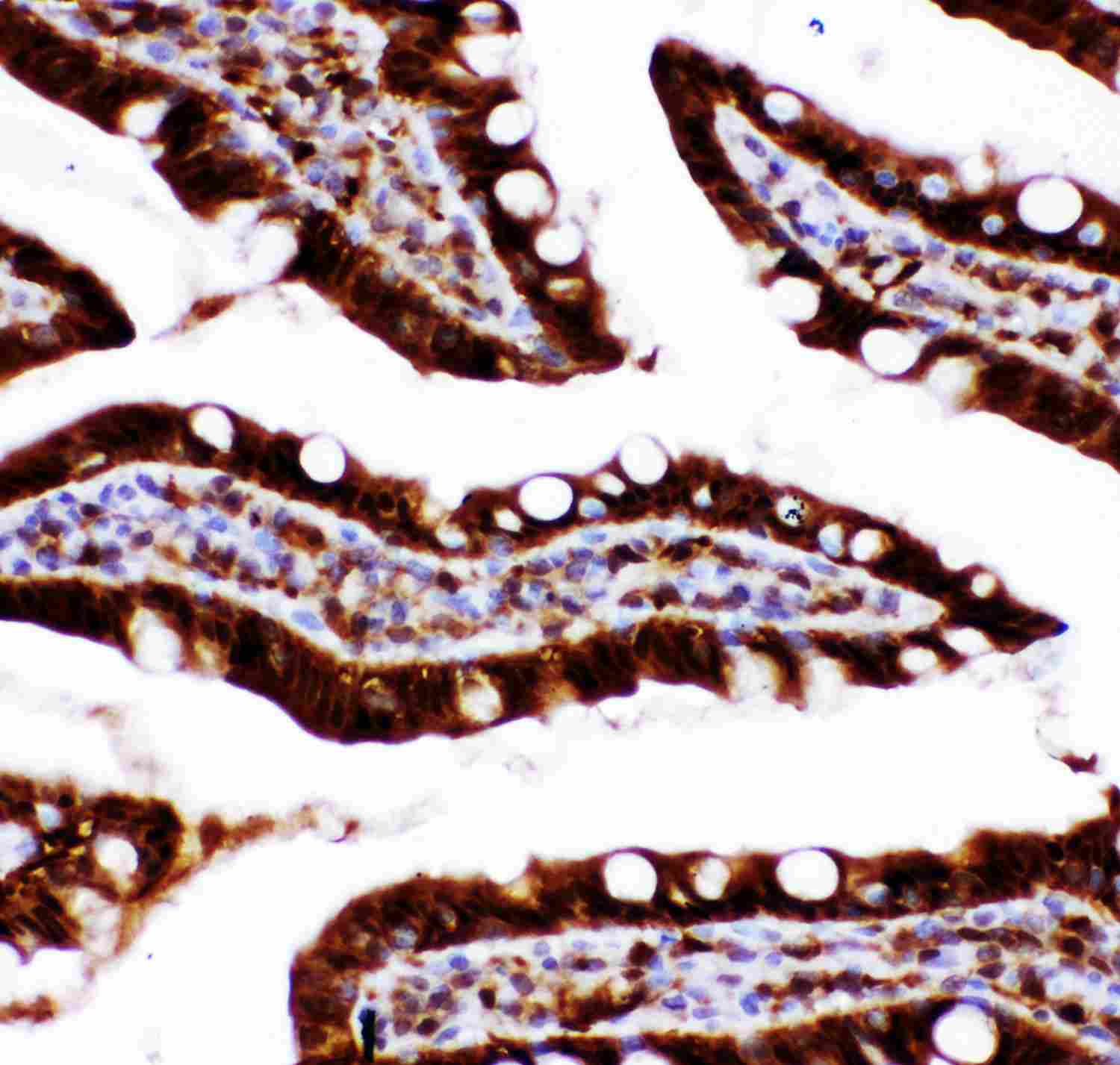 2 - Anti-Caspase 3 Antibody ABO11880
