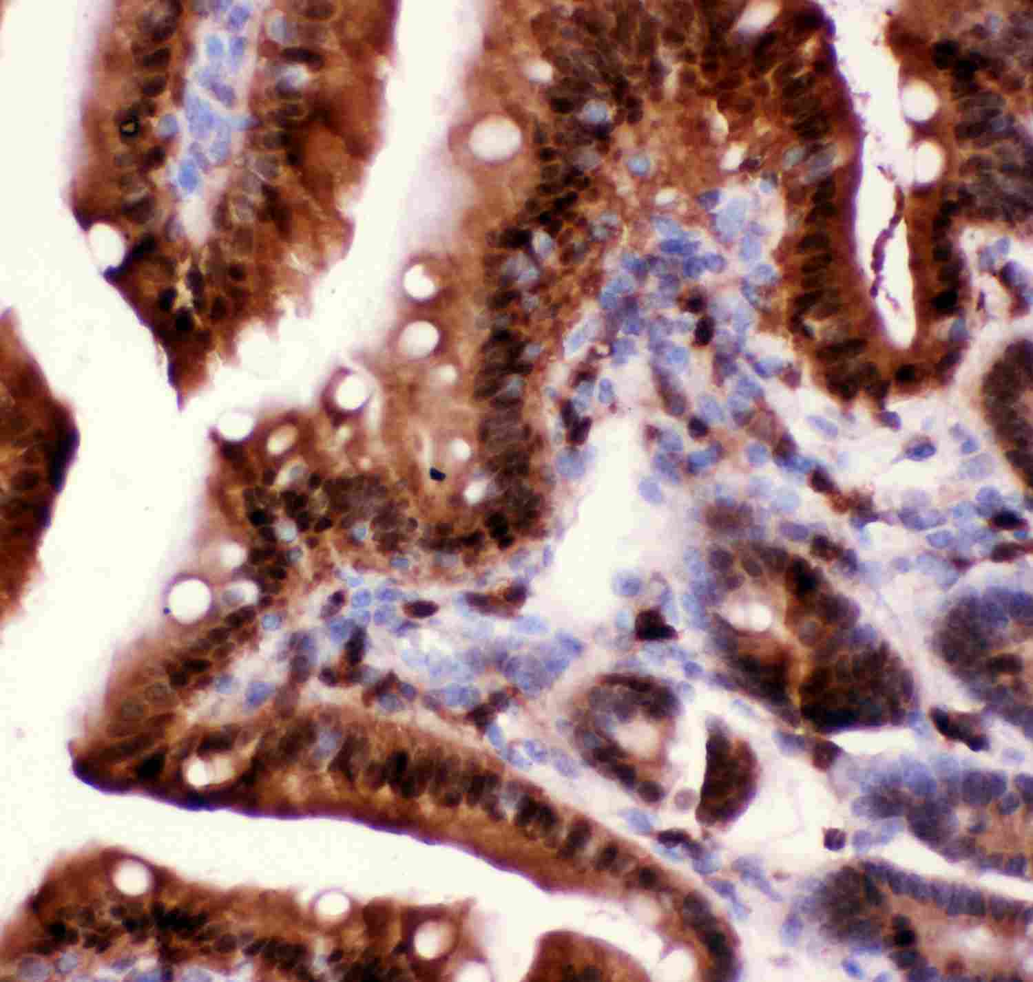 2 - Anti-Caspase 3 Antibody ABO11880